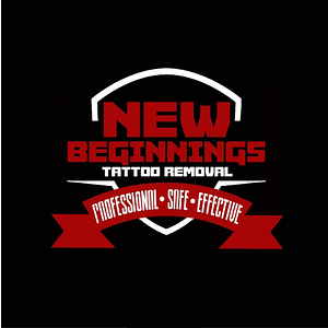 New Beginnings Tattoo Removal