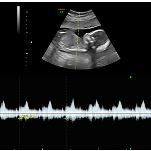 Baby Blessings Ultrasound Studio - Logo