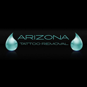 Arizona Tattoo Removal