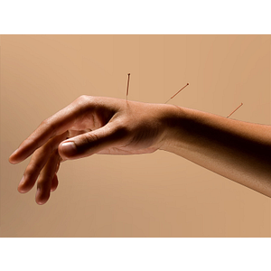 Robert Youngs Acupuncture